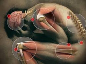 Fibromialgia e tossine — copertina articolo